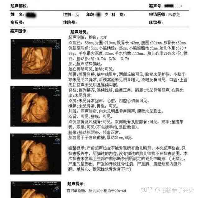 关于四维彩超，四个月能否进行及其重要性